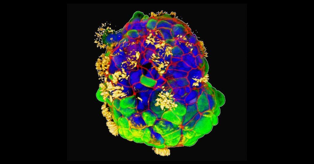 科學家利用人類氣管細胞，打造微型生物機器人「Anthrobots」，能在人體內移動，治療受損的人體組織細胞。