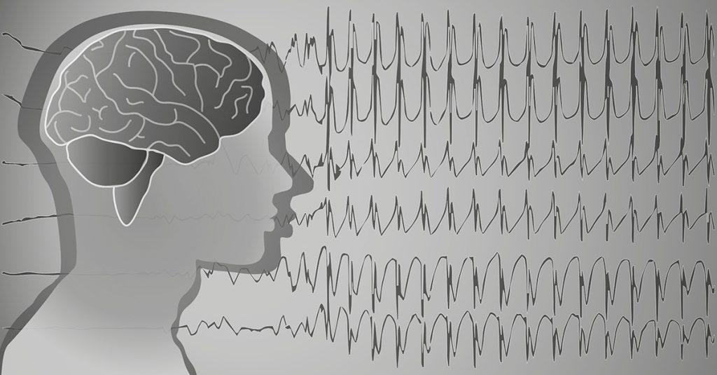 科學家開發了一種「黃金」做的神經，有望徹底改變癲癇、癱瘓與許多慢性疼痛有關的神經系統疾病治療。